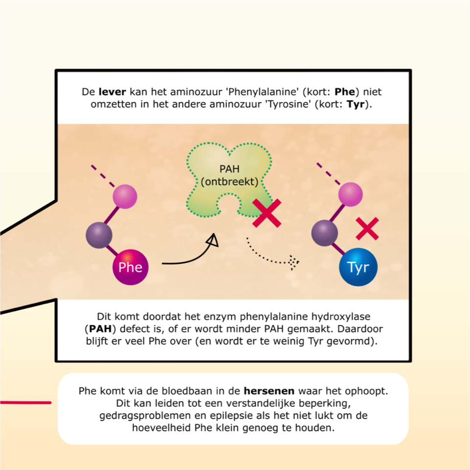 PKU (Fenylketonurie)  infographic afbeelding 1